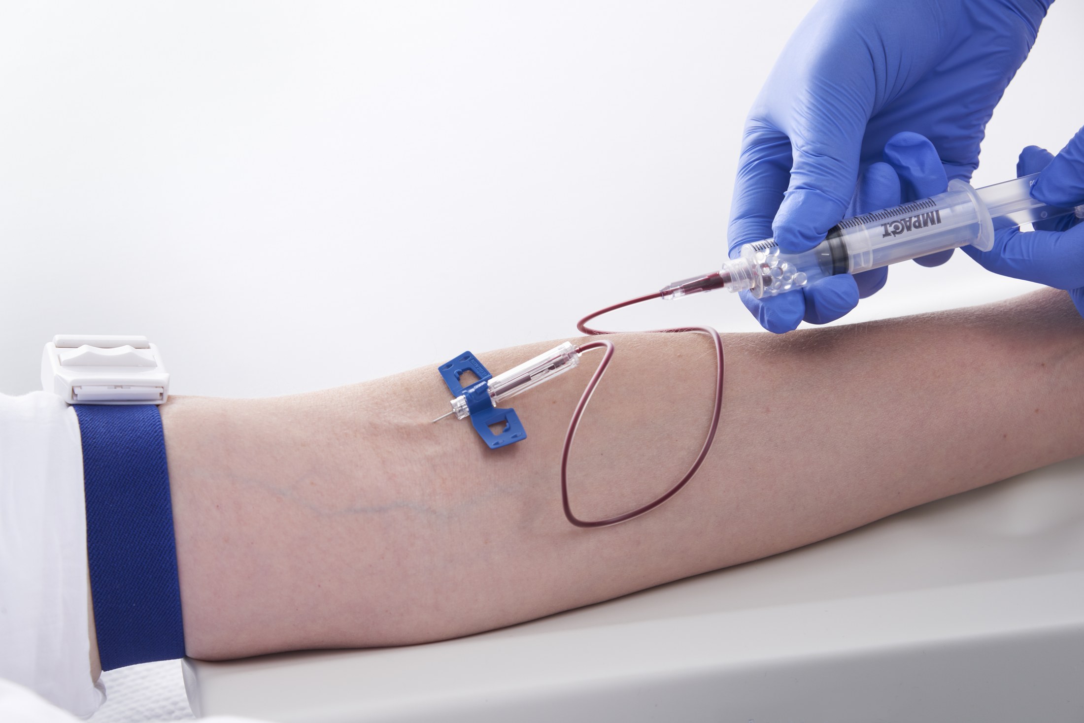 Blutentnahme für die autologe Zelltherapie